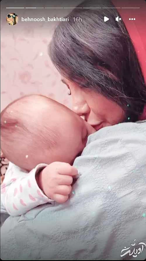 این خانم بازیگر رکورددار جراحی زیبایی ایرانی ! + تصاویری افشاگر !